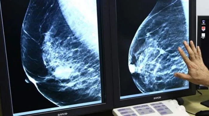 Outubro Rosa: parceria entre Prefeitura de Colatina e cooperativa de crédito disponibiliza 250 exames de mamografia