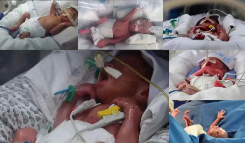 Pais dos sêxtuplos colatinenses divulgam fotos dos bebês