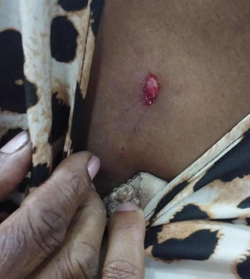 Pitbulls soltos atacam idosa e matam cãozinho de estimação, em Colatina
