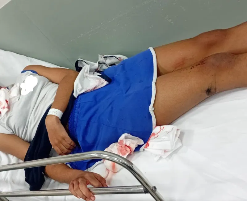 Criança de 10 anos é atropelada a caminho da escola em Colatina